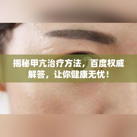 揭秘甲亢治療方法，百度權威解答，讓你健康無憂！